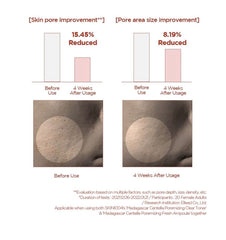 Skin1004 pore-mizing ampoule
