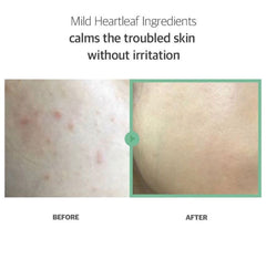 celimax - Heartleaf BHA Peeling Pad