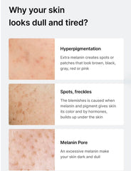 Celimax dark spot serum