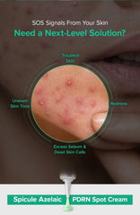 Mary&May - Spicule Azelaic PDRN Spot Cream