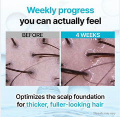 Growus Recover Therapy Hair Booster Serum