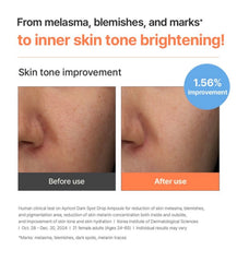 I’m from Apricot Dark Spot Drop Ampoule