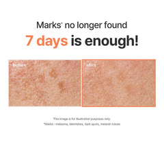 I’m from Apricot Dark Spot Drop Ampoule