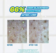 JUMISO - Blackhead Melting Softener Special Set