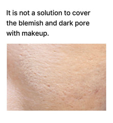 celimax dark spot toner pads