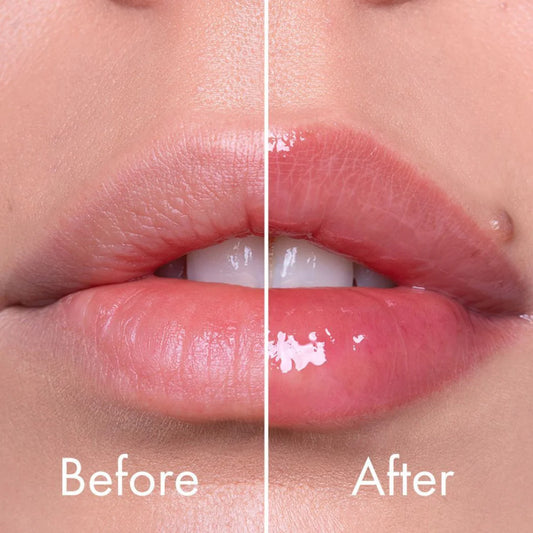 VT - Reedle Shot Lip Plumper Expert