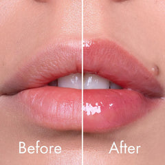 VT - Reedle Shot Lip Plumper Expert